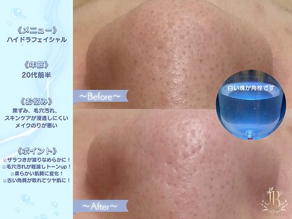 リリーベル 新宿歌舞伎町(Lily Belle)の写真