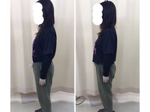 ベルナ(BELUNA)/美しく、誰が見ても綺麗な姿勢へ