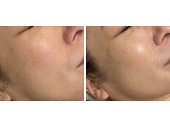 アリィ(Alii)/艶肌で若見え!