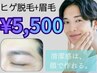 新生活が始まる前に♪【髭脱毛＋眉毛】身だしなみ☆髭剃りからも卒業¥5500
