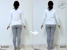 エーアール(AR)/【Before/After】