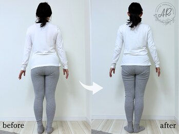 エーアール(AR)/【Before/After】