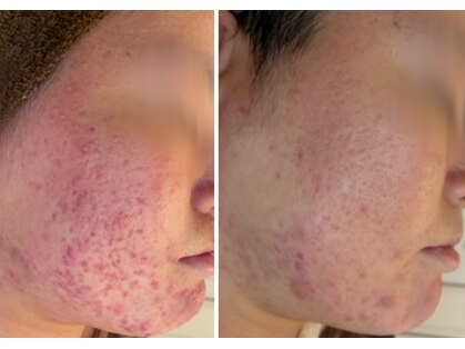 ポアレ(POARE)の写真