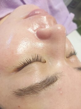 キアラ 麻布十番(Kiara)/顔脱毛