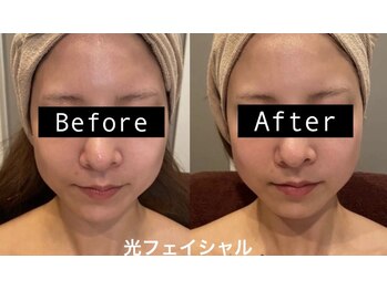 ムーンライズ(moonrise)/