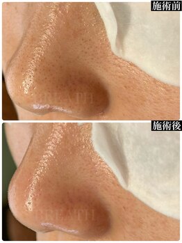 ブレスヘアー アイラッシュ(Breath hair eyelash)/一回でも即触って実感！