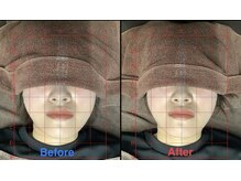 ビタミンスパ 中野店/小顔矯正★施術回数3回