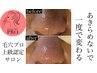 [ここまでしてくれるの!?]毛穴改善×デコルテマッサージ付（120分）￥13,000