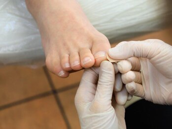 施術【2.テープ貼付】