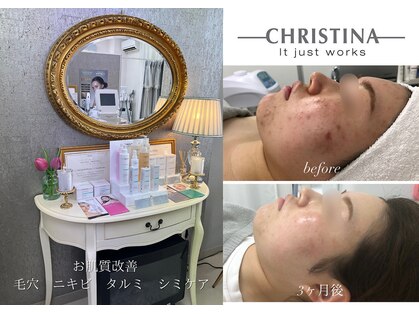 ベルフィーヌボーテ(BELFINE beaute)の写真