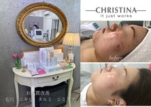 ベルフィーヌボーテ(BELFINE beaute)