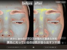 ダイヤモンドトゥルース(Diamond truth)/くすみが飛ぶだけで艶肌美人に