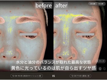 ダイヤモンドトゥルース(Diamond truth)/くすみが飛ぶだけで艶肌美人に