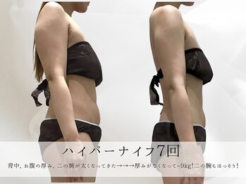 ミヨンラボ(miyon LABO)/ハイパーナイフ 7回