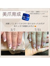 リモナ(Rimona)/美爪育成