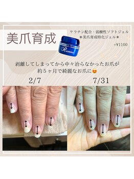 リモナ(Rimona)/美爪育成