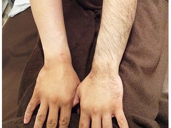 ラヴァコケット 南草津店(Lova'coquette)/腕と手のムダ毛は一気にケア