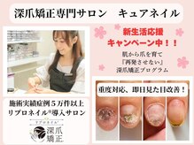 キュアネイル(Qa Nail)