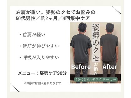 チャーパ(CAAPA)の写真