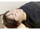 いおり鍼灸接骨院の写真/女性鍼灸師の美容鍼で叶える肌質ケア！シミ・シワを整え自信あふれる素肌へ★