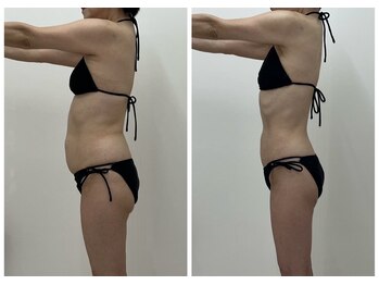 アミクール エステティックサロン(amicoeur)/60代でもこの変化2