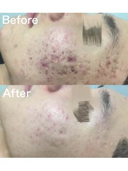 ラ ジェム(La gemme)/【トロイアルケ】