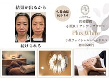 プラスホワイト 久我山