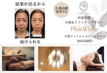 プラスホワイト 久我山