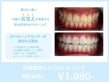 ホワイトニングセンター 谷山店