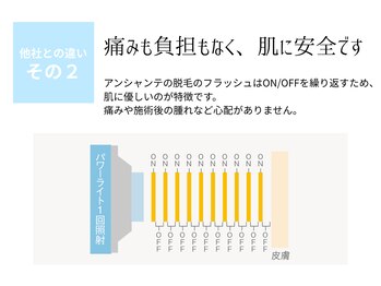 ピュアノア 垂水店/顔脱毛 全身脱毛 神戸垂水明石