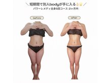 ビループ(biloop)/短期間で別人bodyが手に入る☆