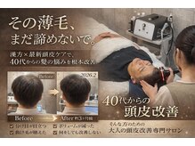 マイントゥー(mine too)