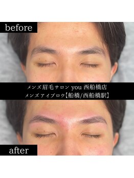 ユー 西船橋店(you)/ビフォーアフター写真