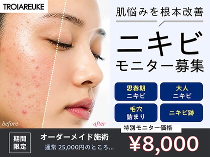 レピア(Le'pia)の写真