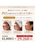 【凹凸が気になる方】お肌の凹凸解消コース｜通常￥41,800→30％OFF￥29,260