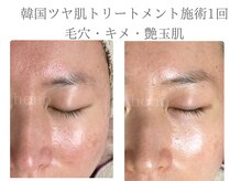 いごこちいい場所 ほのほの/1回でも実感してもらえる実績