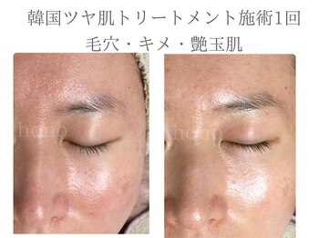 いごこちいい場所 ほのほの/1回でも実感してもらえる実績