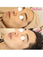 メゾリーナ(MAISOReNA)/メンズも肌管理の時代