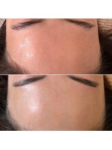 サロン ド ミモザ(Salon de Mimosa)/フェイシャルWAX