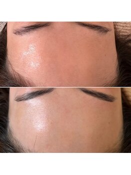 サロン ド ミモザ(Salon de Mimosa)/フェイシャルWAX