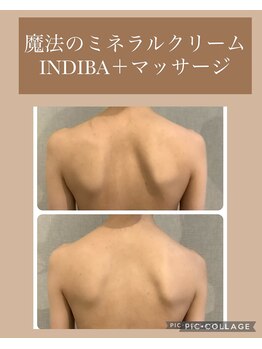 リーチェ ビューティー(Riche Beauty)/肩甲骨周り・筋膜を緩める