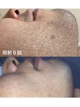 エースビューティー(Ace.Beauty)/