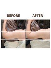 サンシャイン(Sunshine)/40代女性ビフォーアフター