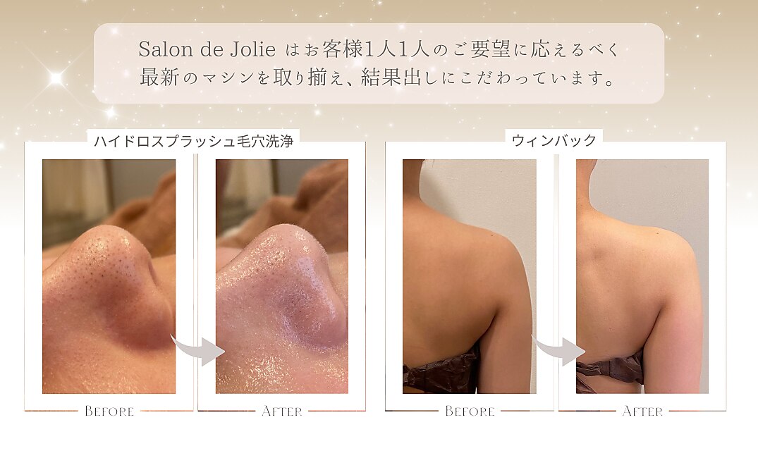 サロンドジョリー(Salon de Jolie)｜ホットペッパービューティー