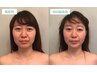 【小顔矯正初めての方】１回でむくみ・たるみも改善！顔集中30分