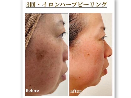 レア(Le'a)の写真