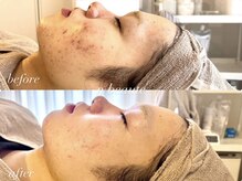 エヌボーテ(n beaute)