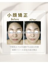 イチカ 仙川店( ichika)/小顔矯正　歪み　左右差