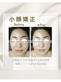 イチカ 仙川店( ichika)/小顔矯正　歪み　左右差