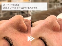 レイテノール 藤沢店/角栓ごっそり！毛穴洗浄コース